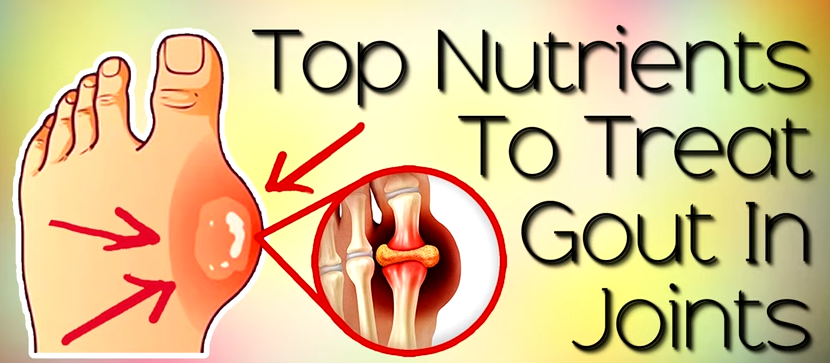 The best nutrients to treat gout and uric acid crystals in the joints.