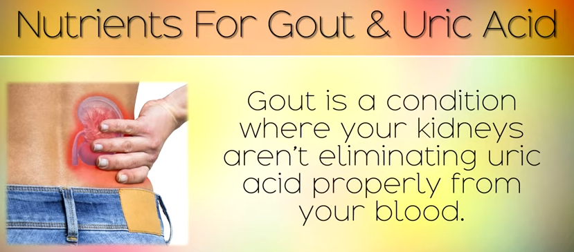 Gout is a condition where your kidneys aren't eliminating uric acid properly from your bloo