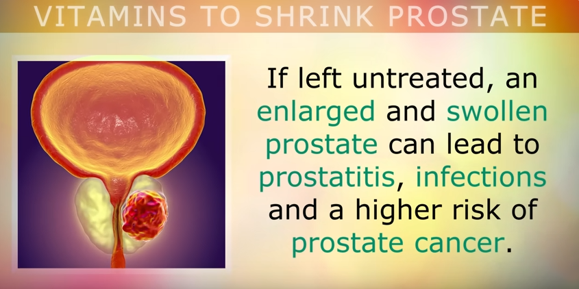 SHRINK PROSTATE