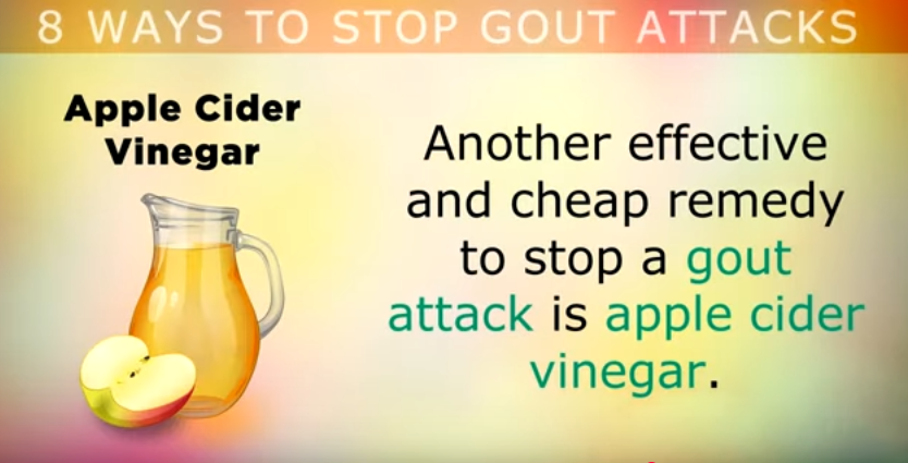 Apple cider vinegar for Gout Attacks