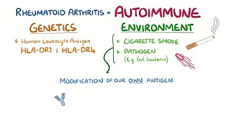 Arthrosis vs arthritis symptoms